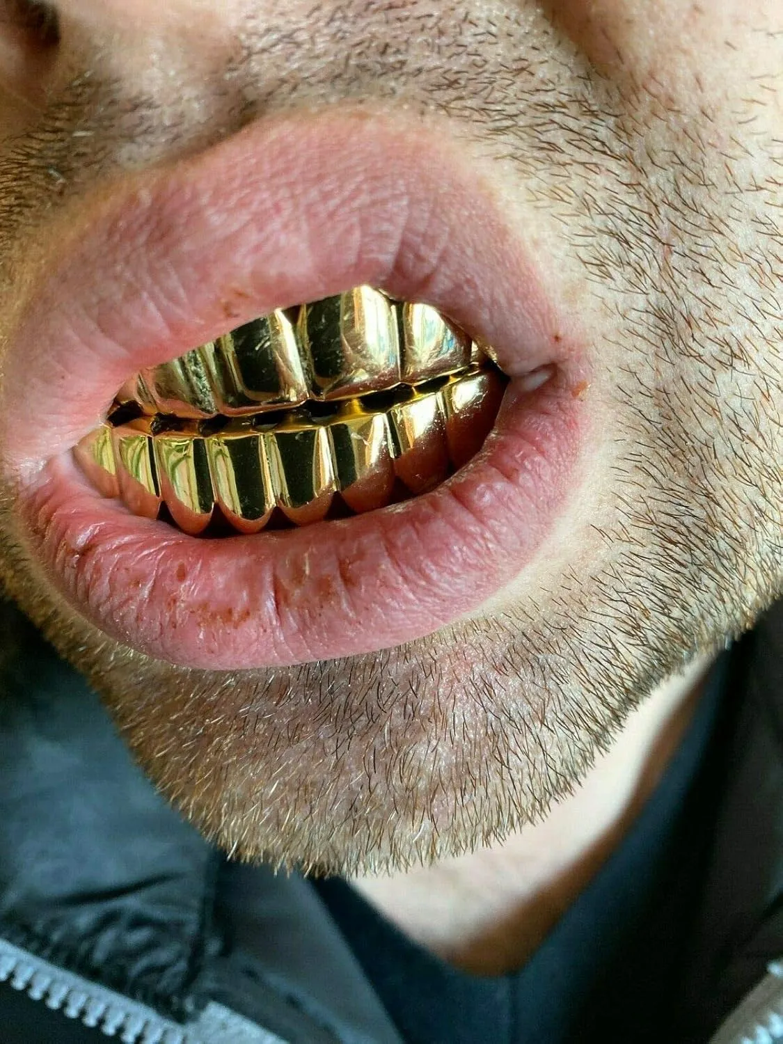 Solid 925 Sterling Silver Grillz - 14K Yellow Gold Finish - 6 Or 8 Tooth Or Single Caps/Top & Bottom Grills For Teeth - Real Solid Silver Fronts Don't Change Color